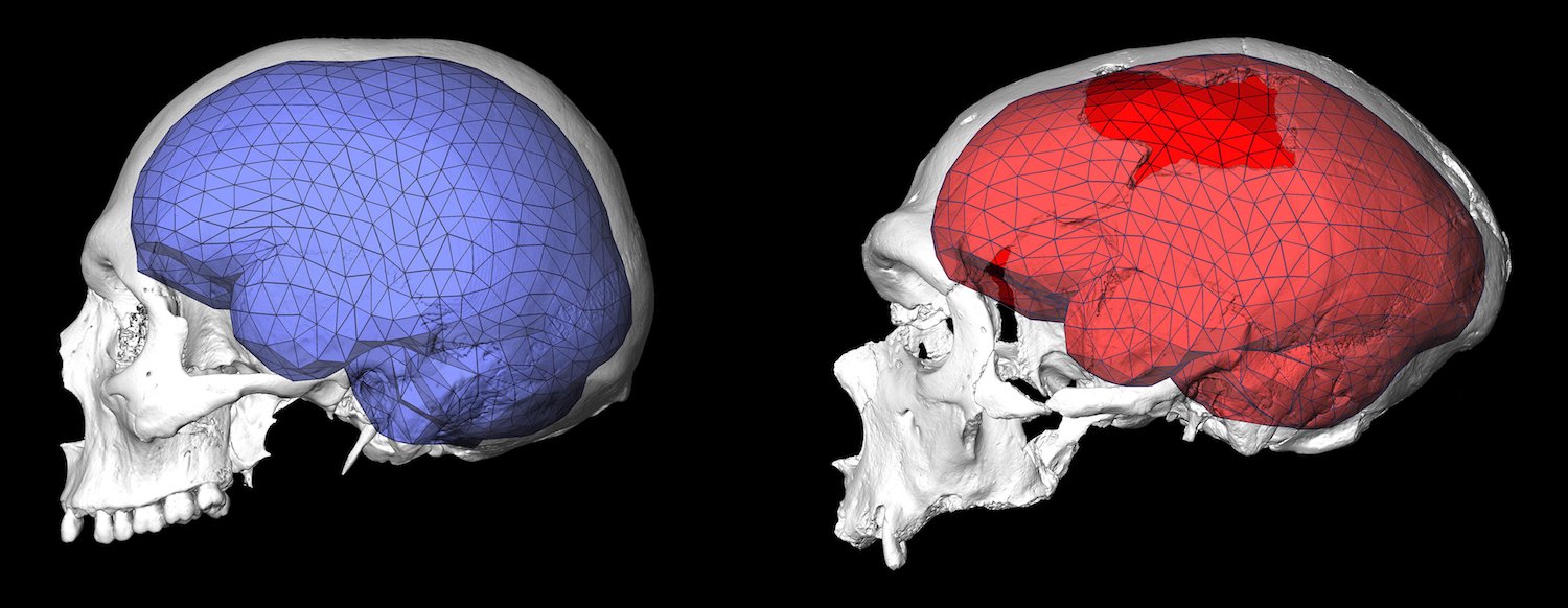 Modern İnsan Beyni Yaklaşık 40.000 Yaşında