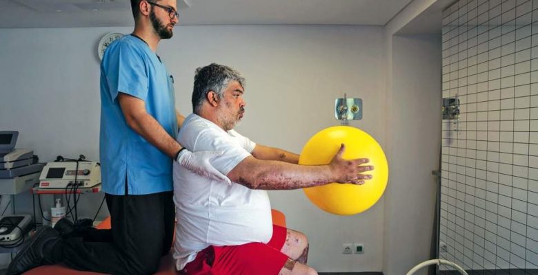 Birçok Mati yanık kurbanı için uzak bir umut kurtarma